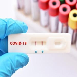 test antigenico covid 19 2 1